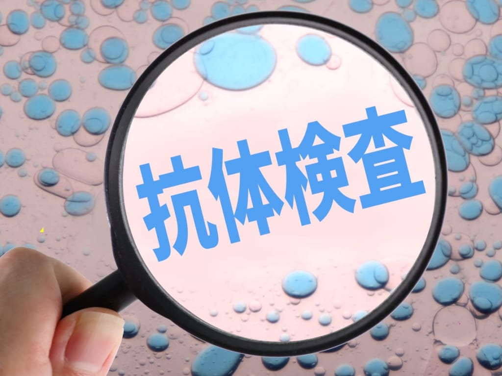 抗体検査